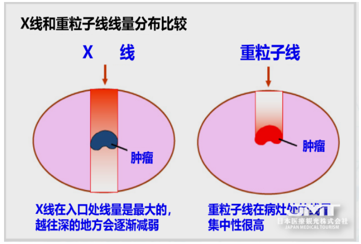 重离子治疗是什么？适合哪些疾?。?>
							</a>
						</div>
												<div   id=