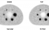 <p>山西医科大学第一医院PET/<font color=red>CT</font>科研成果发表于Scientific Reports杂志</p>
