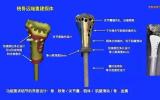 市级医院首例!依靠3D打印技术保住骨肉瘤患者的左手