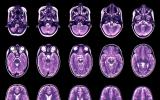科学家们绘制出了人类生命周期中的大脑图表